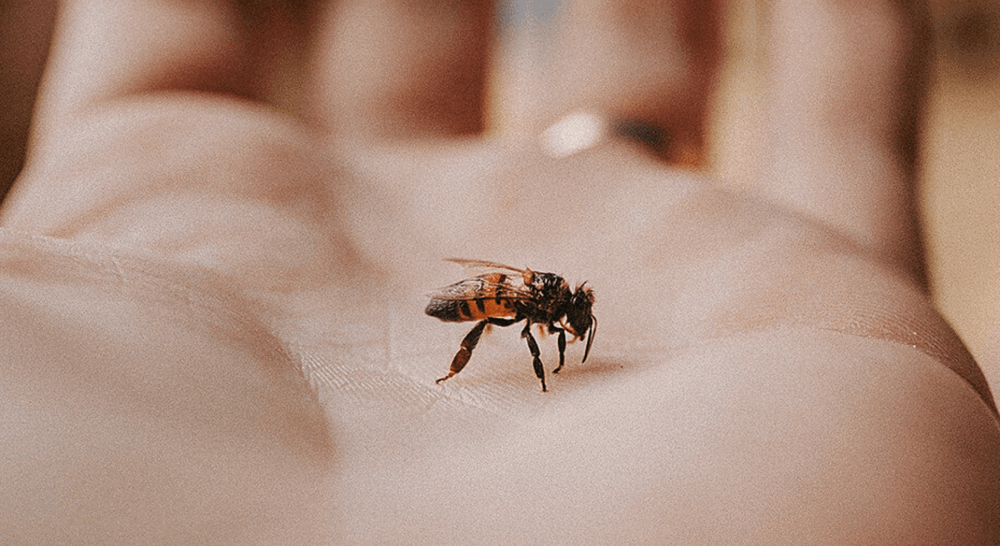 Народний метод чи аптека? Як правильно діяти після укусу бджоли